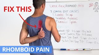 How to Fix Upper Back \/ Rhomboid Pain for GOOD (4 Effective Exercises)