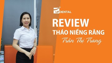 [Review niềng răng]: #72 Kết quả niềng răng của Trần Thị Trang