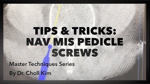 Master Techniques: How Dr. Choll Kim Places Pedicle Screws with Navigation and the 5mm Burr...