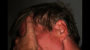 Stop Blushing Hypnosis | Hypnotherapy Recording To Stop Blushing and Reduce Anxiety