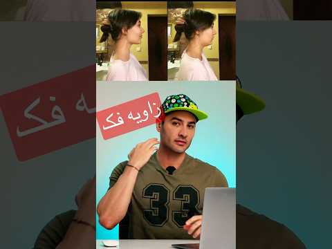 زاویه فک صورت بدون تزریق و جراحی