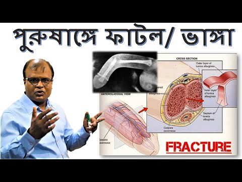 ভিডিও: আনিজ সাধারণ - ওষুধ এবং সিজনিং উভয়ই