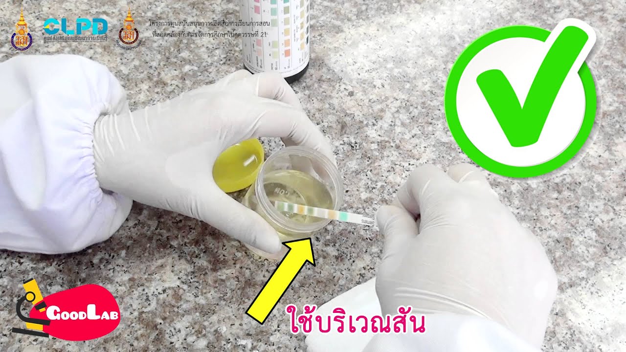 การตรวจปัสสาวะในงานประจำวัน (Urinalysis in routine)