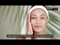Flower Mound &amp; Coppell, TX Botox Treatments for Marionette Lines Explained