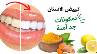 تبييض الاسنان من اول إستعمال ،بخلطة طبيعية بالكركم(الخرقوم) +الليمون(الحامض) تعالج اللثة ورائحة الفم
