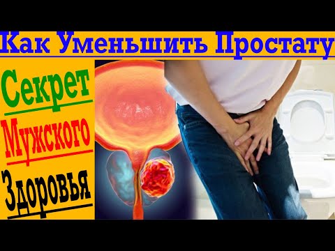 Как Уменьшить Простату?! Секреты мужского здоровья!