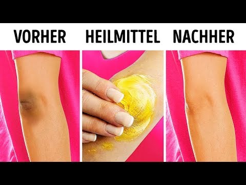 Video: Ellenbogen reinigen – wikiHow