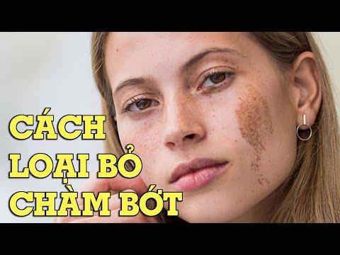 Video: 3 cách để xóa mụn dưới da