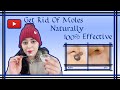 तिल और मस्से को जड़ से हटाने के उपाय Remove Skin Tags, moles Naturally #moles 100% Effective #nuskha