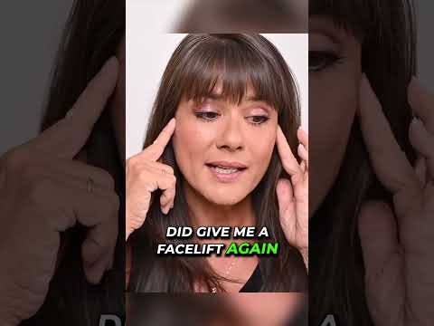 Facelift Tape Work?