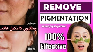 Dark spot, Pigmentation Issue-چہرے کی چھائیوں کا علاج-Melasma- Remedy for Hyperpigmentation in 5 min