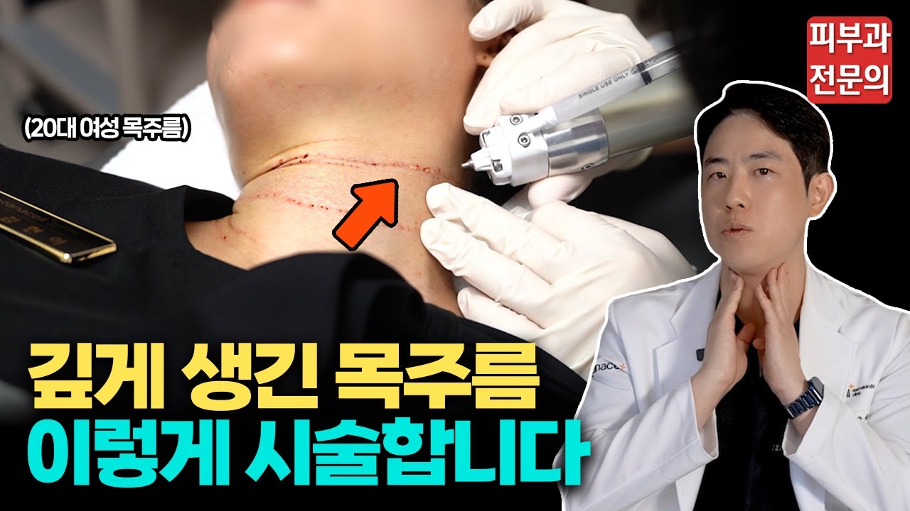 확 늙어보이는 목주름 피부과에선 이렇게 없앱니다 / 피부과 전문의 목주름 시술