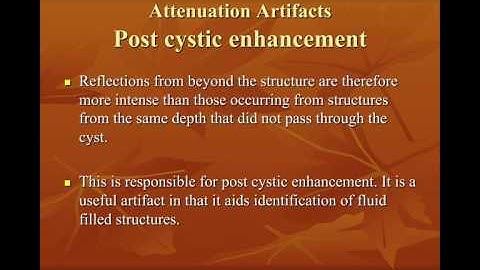 Ultrasound Artifacts