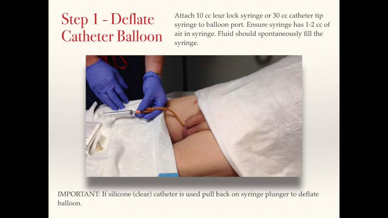 Male Foley Catheter Removal Best Practice Guidelines YouTube