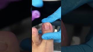 Nail cleaning services 😌🤗🥵"/((#shorts #public #satisfying #nails #explore #lifeisbutadream #love )