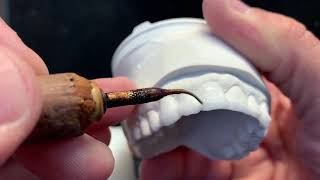 Plan your Smile with Diagnostic Wax Ups by Drake Dental Laboratory