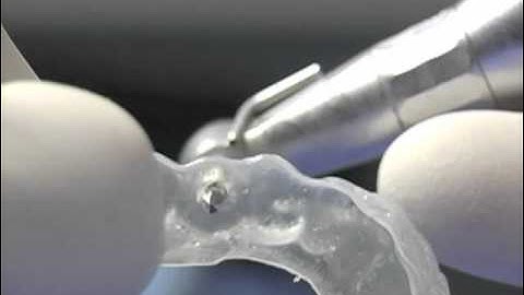 Dental Implant Surgical Guide Fabrication Prior to Digital Implant Dentistry Workflow
