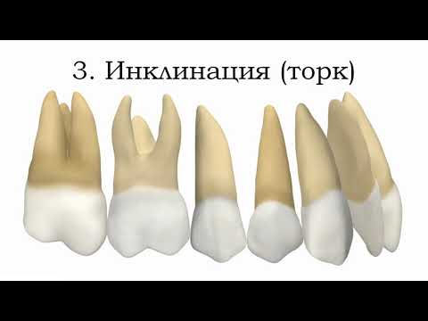 6 ключей окклюзии по Эндрюсу