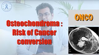 Understanding Osteochondromas: Risk of Cancer Conversion | Secondary Peripheral ACT/CS1 Explained