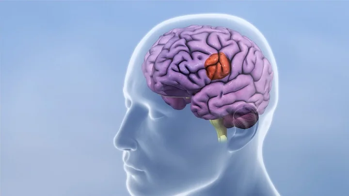 Breakthrough in the fight against glioblastoma