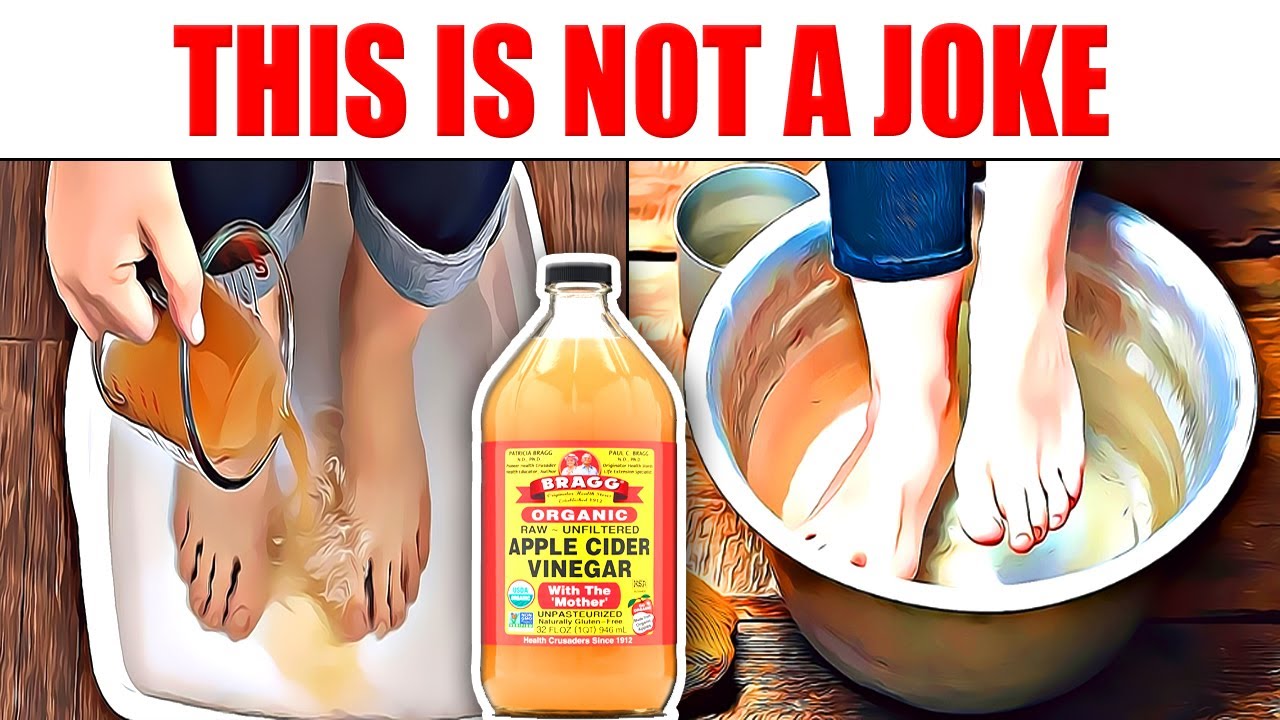 Dip your legs in the soaked apple cider vinegar! you will be amazed at the results! YouTube
