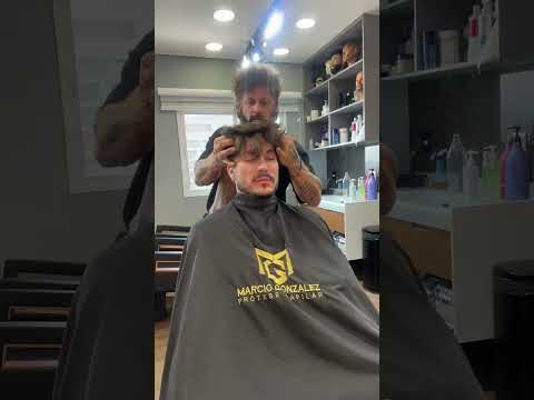 Vídeo explicando como funciona a prótese capilar