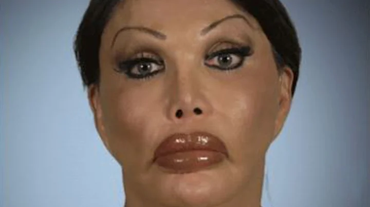 Transgender Plastic Surgery Addict - Monique Allen