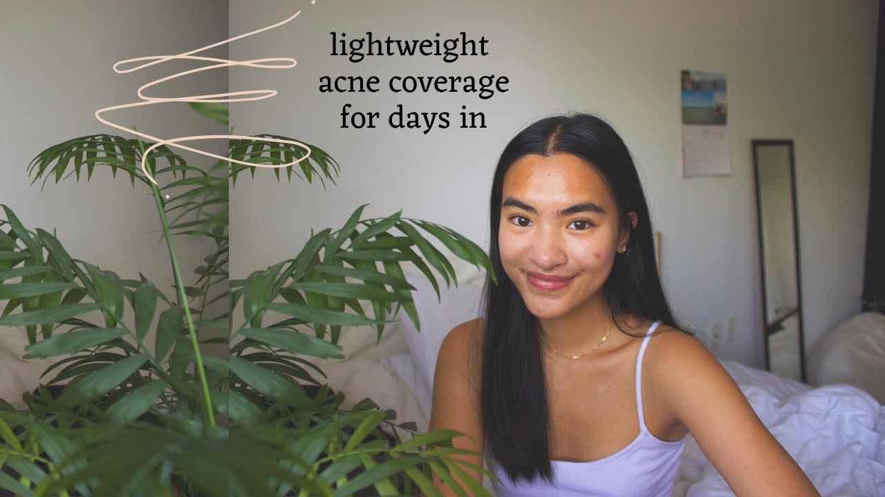 lightweight acne scar coverage that won’t break you out +how to feel more comfortable with acne talk