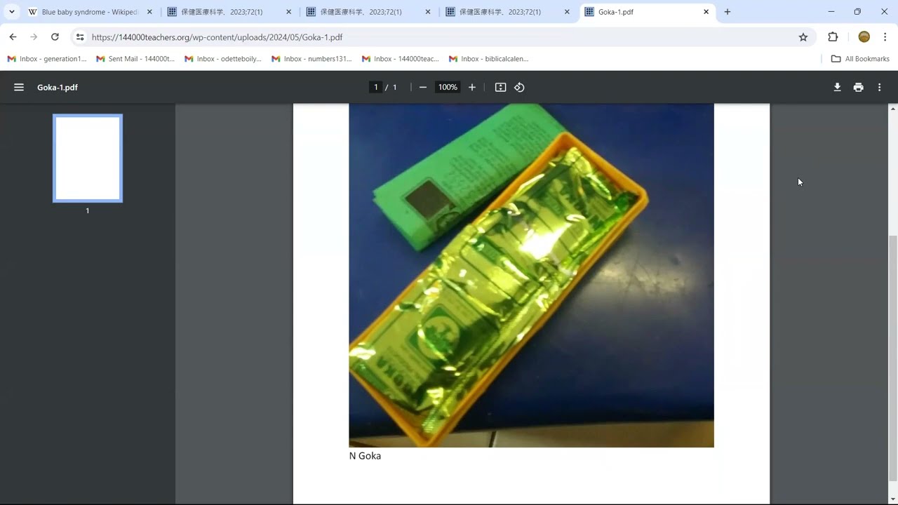 Methemoglobinemia - Blue Baby Syndrome