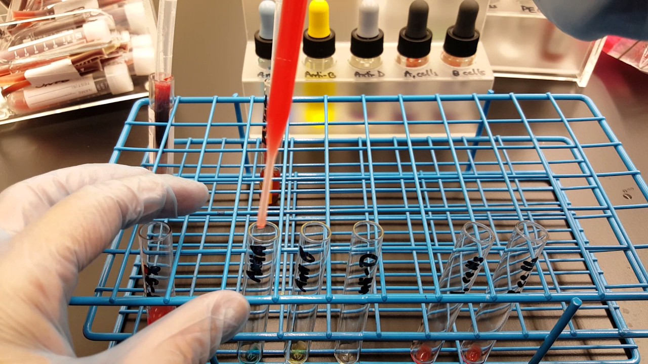 Blood Banking ABO&D testing Part 1 YouTube