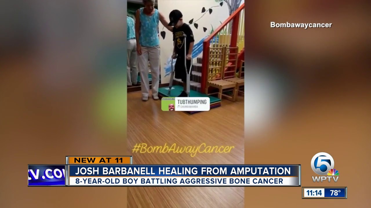 vero beach weather Josh Barbanell, boy battling bone cancer, learning to go on stairs with crutches