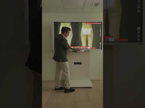 Paciente de liposucción y lipofilling.