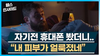 [헬스인사이드] 자기전 휴대폰 봤더니.. &quot;내 피부가 얼룩졌네&quot; / 머니투데이방송