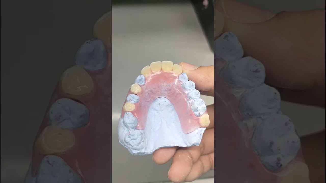 casted clasp Denture, flexite and Hawley Retainers