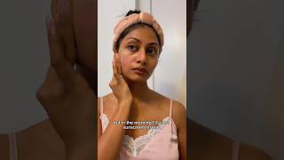 Skin Care Routine for Sensitive Eczema Prone Skin ? Before & After Shown ✨