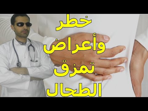 تمزق الطحال | أعراض وأسباب لا تتجاهلها