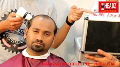 Headz hair fixing - Most Advanced Hair bonding in Bangalore -Call 9886161166