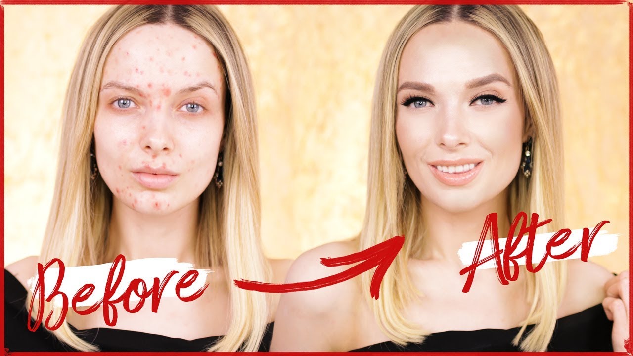 KENDALL JENNER ACNE COVERAGE MAKEUP TUTORIAL! // MyPaleSkin
