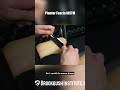 Plantar Fascia IASTM