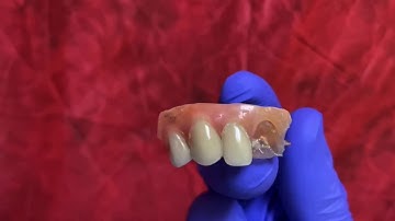 How to fix broken denture tooth