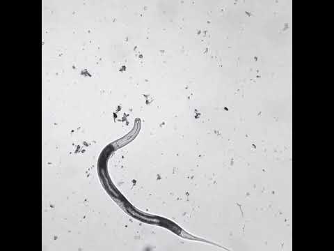 Video: Nematodlu Eelworm Control - Kartofdakı Eelworms haqqında öyrənin