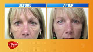 Anti Ageing Eye Treatment and The Latest Trend in 2020!