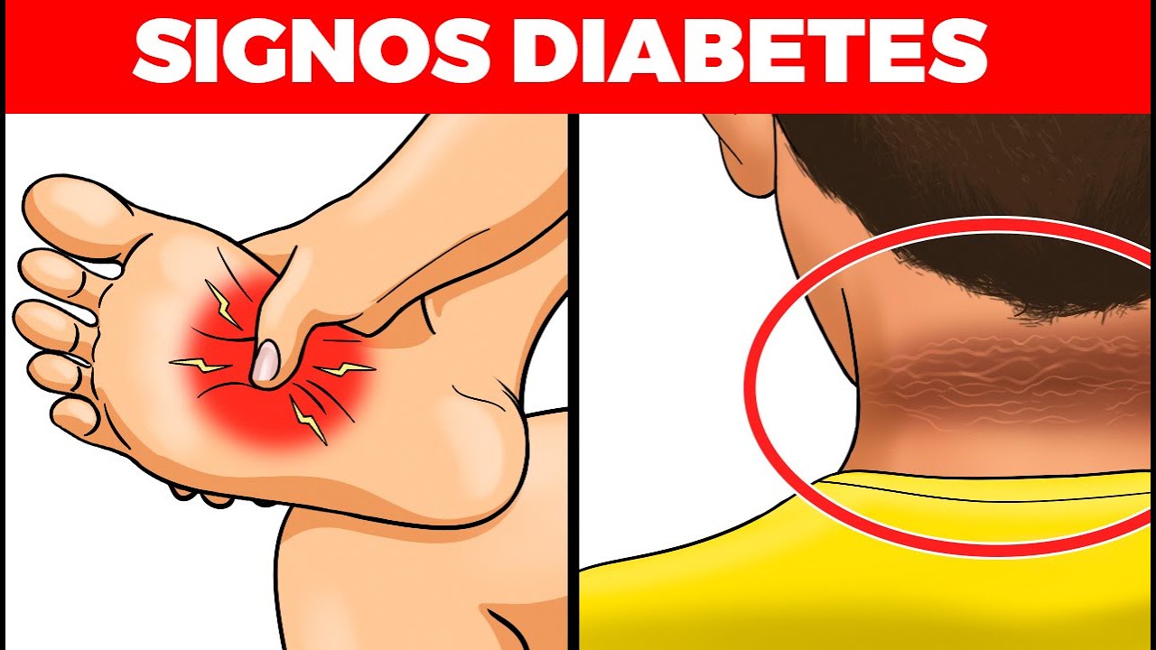 dieta de diabetes daun untuk mengeringkan luka dieta de diabetes daun untuk mengeringkan luka