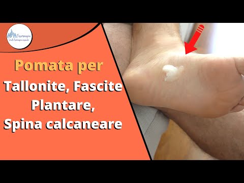 Pomata per Fascite plantare, Tallonite, Spina calcaneare