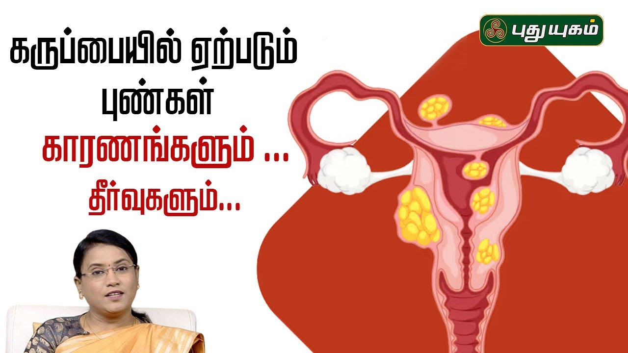 கருப்பையில் ஏற்படும் புண்கள்... காரணங்களும் தீர்வுகளும்...  Dr.MS.UshaNandhini #yugamconnect