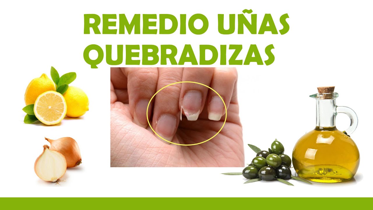 Frena la CAIDA DE CABELLO estos remedios caseros. -