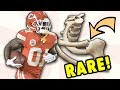 Tyreek Hill Hospitalized with RARE Shoulder Injury! Doctor Explains SC Dislocation