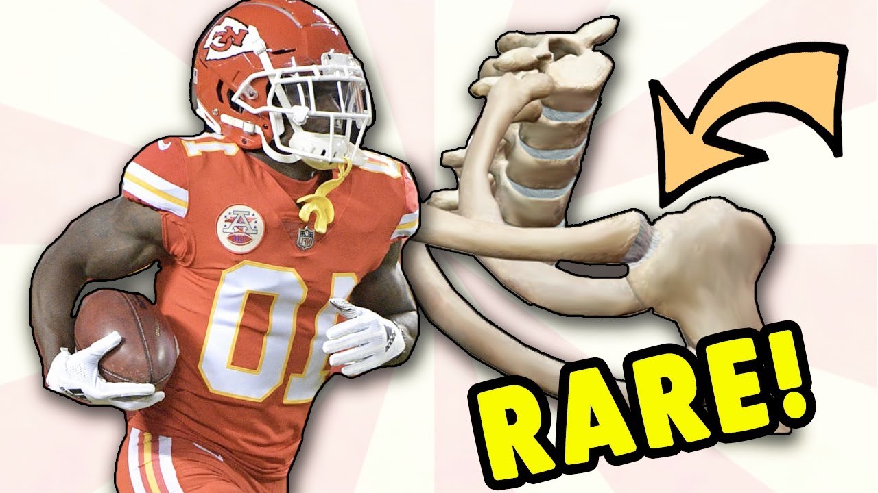 Tyreek Hill Hospitalized with RARE Shoulder Injury! Doctor Explains SC Dislocation - YouTube