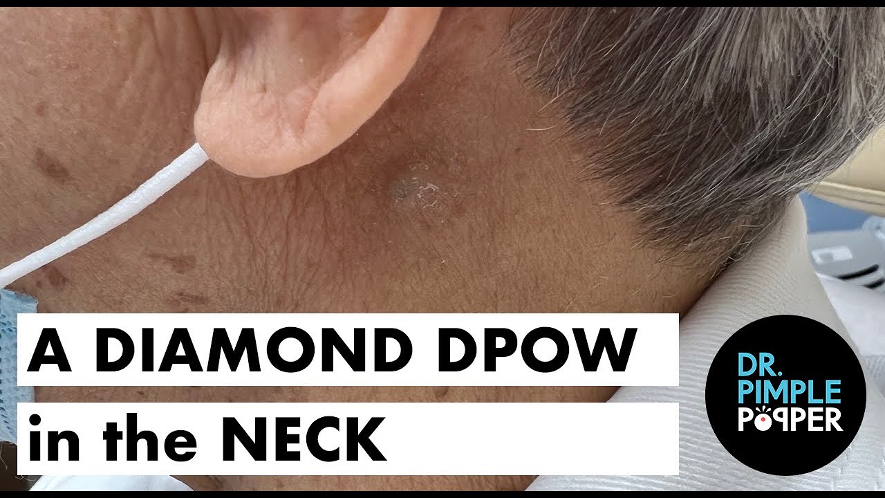 Neck DPow 2023 video