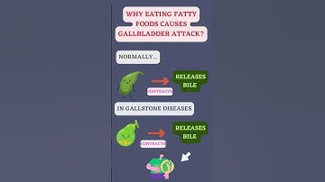 WHY EATING FATTY FOODS CAUSES GALLBLADDER ATTACK? #shorts